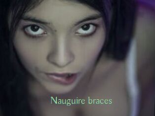 Nauguire_braces